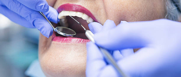 Best Emergency Denture Repair in Lexington, WA